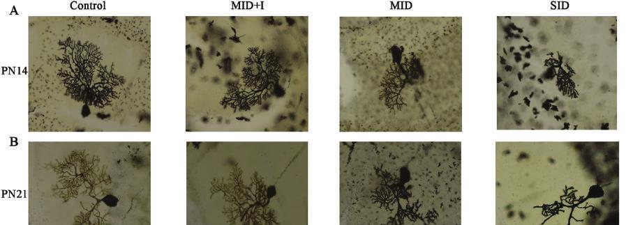 Figure 4 Dendritic branches of Purkinje cells in the cerebella of rat offspring at postnatal day 14 (PN14) and 21 (PN21) when born by rats with different iodine intake during pre-pregnancy, pregnancy