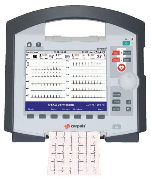 Litt mer om CorPuls Multimonitor som finnes i alle ambulanseenheter, på legevakter, fastlegekontor og sykehus EKG lastes til webløsning slik at sykehuslege kan se samme EKG som ambulanse LV-lege