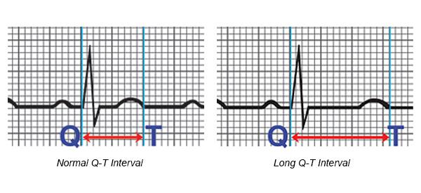 31 Kirurgi ved Rikshospitalet Preoperativt med pediater/barnenevrolog: - Optimalisere