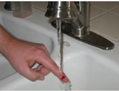 Myte 5: Sterilt isotont saltvann må brukes til rensing av sår Vanlig å bruke sterilt isotont saltvann til skylling/vasking av sår.