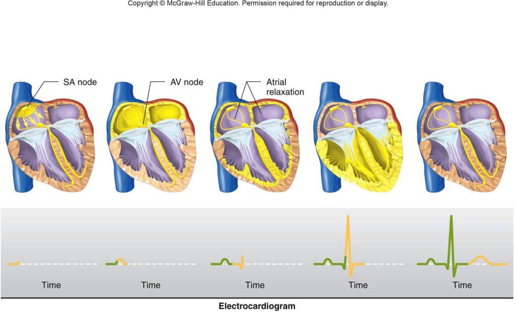 Hva indikerer QRS-komplekset i elektrokardiografi (KG)?