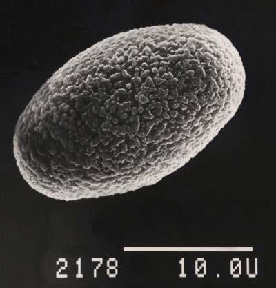 Roy Kristiansen gation of P.babingtonii from Pachyella is suggested by Hansen et al. (loc. cit.). In MycoKey (2011) an illustration of one ascospore of P. babingtonii marked Henry Dissing Gr 82.