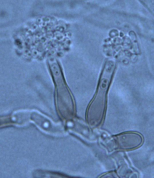 Halvor Solheim et al. Figur 2. Konidier og pigmenterte phialider til Chalara fraxinea, det anamorfe stadium til Hymenoscyphus pseudoalbidus.