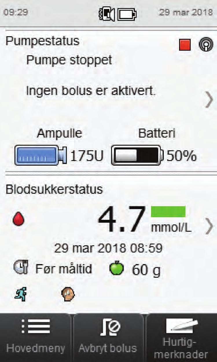 Stopper insulintilførsel fra pumpen. Velg Ja.