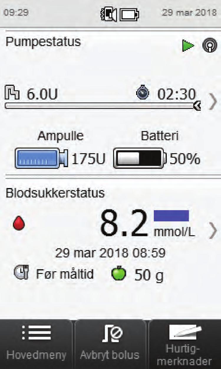 6 3 4 5 MERK Hvis du velger Tilbake, kommer du tilbake til det forrige skjermbildet uten at det tilføres noen bolus.