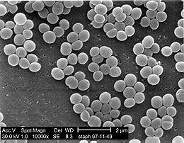 Polymikrobielle infeksjoner Gram