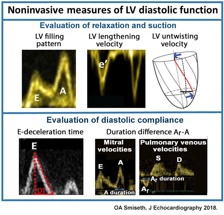 Figur 3: Noninvasive mål for diastolisk dysfunksjon. Diagnostikk Diagnosen hjertesvikt bygger på en samlet vurdering av klinikk og spesialundersøkelser.