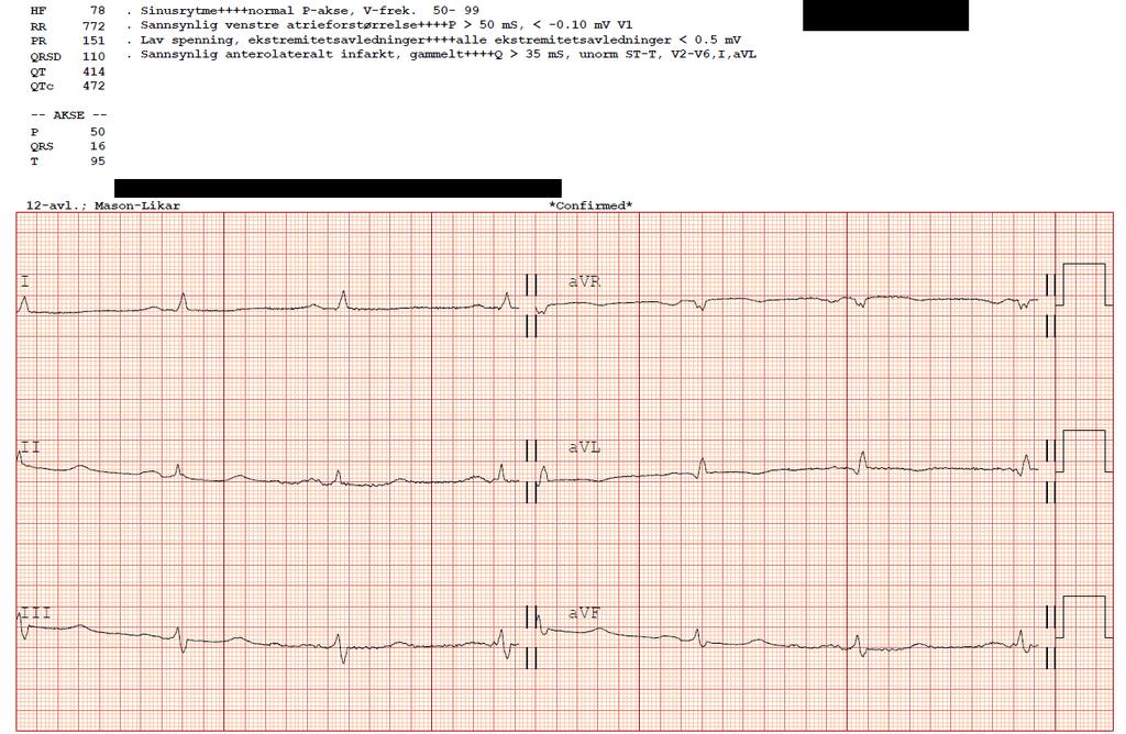 EKG 01.