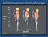 Spinal osteoporosis: structural changes (diagram) Siri Dyvik 10.2.16