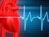 Angioplastikk ved akutt hjerteinfarkt hos pasienter overført fra annet sykehus