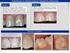 Dental Cone Beam CT. Gerald Torgersen. Kvalitetskontrollarbeid (QA) - optimalisering og dosereduksjon