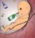 Alkohol og graviditet