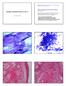 Mucoepidermoid carcinoma Def: (WHO 2017) Malign spyttkjerteltumor del 2. Februar 2018