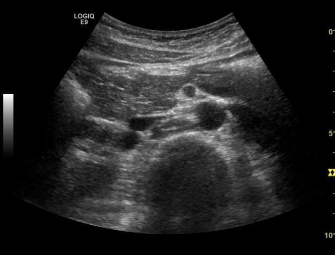 Caput Corpus Organundersøkelse -Pankreas Stasjon 1 (og 5) Innsyn kan bedres ved ve.