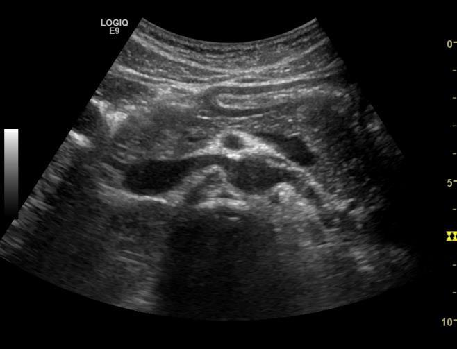 Lengde: 13-15 cm Bredde: 2 cm caput, 1 cm corpus og cauda Uregelmessig overflate