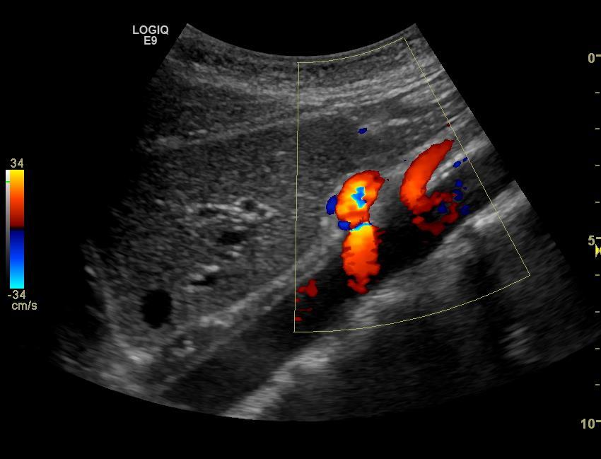 Stasjon 1-6 -Stasjon 2 Lengdesnitt epigastriet V.