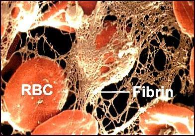 Fibrinolysehemmer Hindrer fibrin i å løses opp.