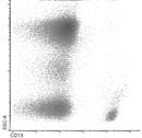 merking 1)Pasientens celler 2)Antistoff mot CD19 FITC -merket 3)Alle B-lymfocytter er merket med anti- CD19 4)Avlesning i Flowcytometer Y Y + = Y Y Y Y 13 CD19 Flowcytometri Rask - timer Enkeltceller