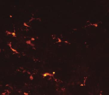 (a) TUNEL positive cells (red, left figure) in layer V of 16 treated cortex at P.