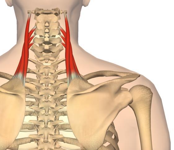 Levator scapulae 19 Triggerpunkter øvre