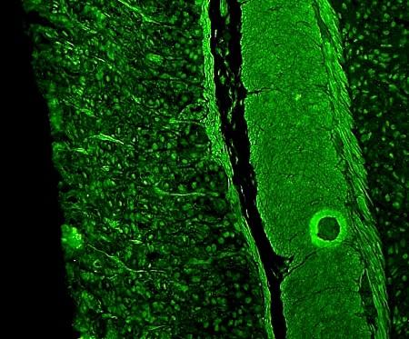 22 AGM I Indirekt Immunfluorescens: Hva ser man på bildet?