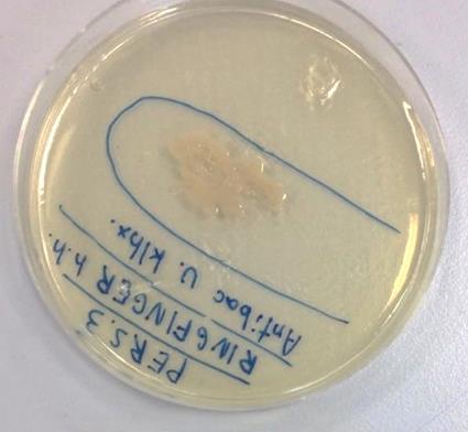 Hos alle skålene der vi hadde renset fingrene med Antibac uten klorhexidin resulterte med at det ikke vokste fram bakterier, bortsett fra i én skål.