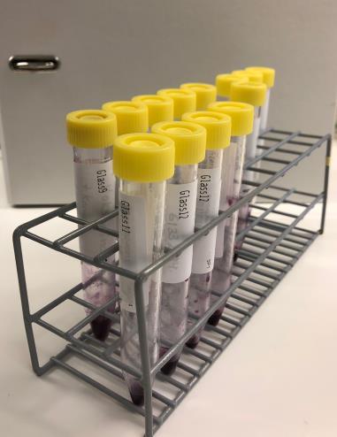 Kompetanse heving gjennomføring Samler patologiske prøver i kjøleskap 2 case patologiske prøver Gruppe