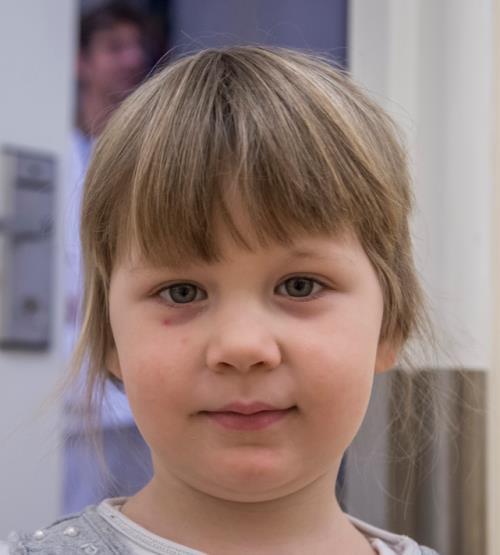 Case: PNES og Autismespekterforstyrrelser Jente 10år (Anne) med PNES og udiagnostisert autisme- spekterforstyrrelse (ASD), ikke IU.