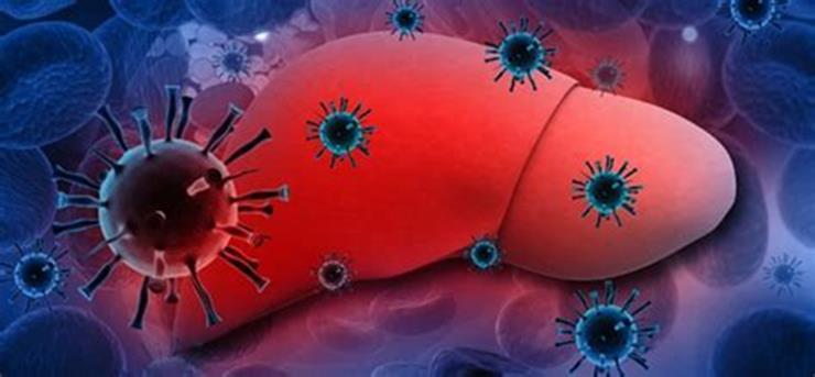 Hepatitt c Viruset oppdaget i 1988, test fra 1989 Sykdom som i stor grad er knyttet