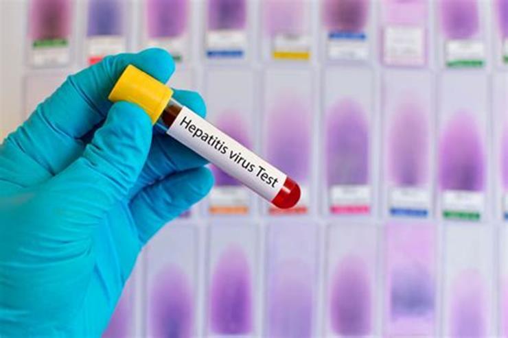 Hepatitt c Mange har antistoff mot hepatitt c Ikke alltid en aktiv infeksjon viktig å avklare med test Direktevirkende
