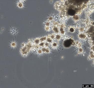 Planteplankton er encellede frittsvevende mikroskopiske organismer. Veksten til planteplankton er styrt av en rekke faktorer.