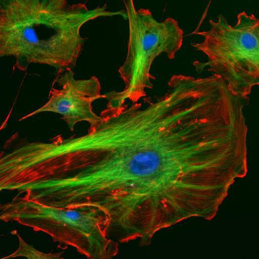 Cytoskjelett farget rødt (mikrofilamenter) og grønt (mikrotubuli). Nukleus er blå. Kilde: Wikipedia 17 Forslag til animasjoner The Inner Life of a Cell, Harvard http://www.