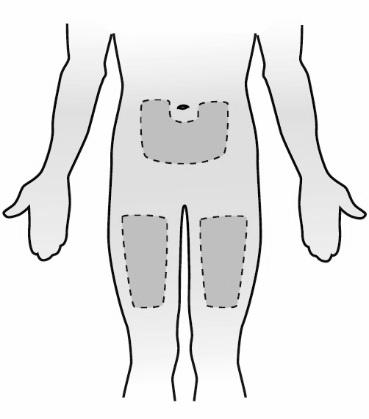 2. KLARGJØR FOR INJEKSJON Velg injeksjonssted på enten magen eller forsiden av låret. Du kan bruke samme kroppsområde ukentlig, men bruk forskjellige injeksjonsteder innen dette området.