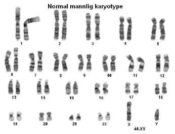 Kromosomanalyse DNA-analyse av gener