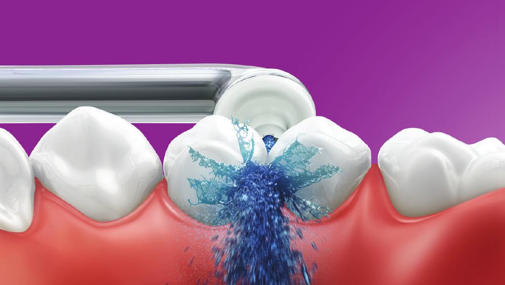 I en studie med brukere som anvendte tanntråd uregelmessig ble det observert at 96 % av pasientene fortsatt brukte Airfloss fire dager i uken eller mer etter 3 måneder en perfekt løsning som fungerer