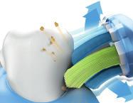 Børstehodets fleksibilitet hjelper børsten å spore forsiktig langs tannkjøttkanten og absorberer overdrevet børstetrykk.