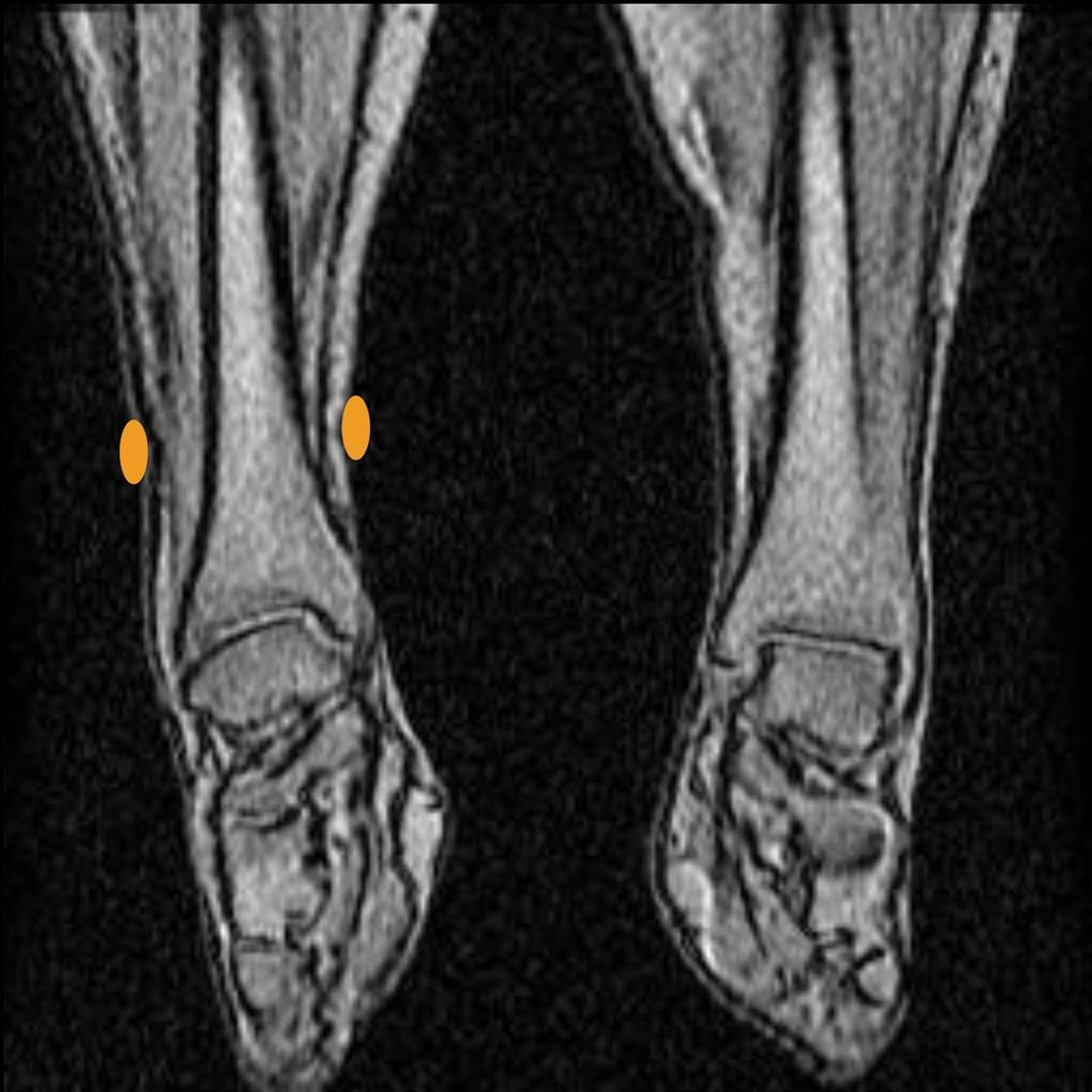 Make sure the Ankle images show the ankle joint