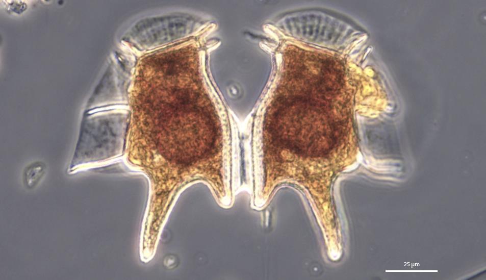 B: Grønnalgen Pediastrum duplex,