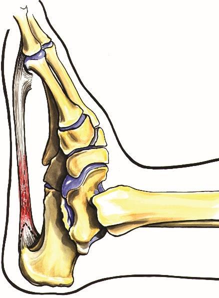 Fot Anatomi fot Skjelettet i foten består av fotroten (en rekke fotrotsknokler: calcaneus, talus, os cuboideum, naviculare og cuneiforme mediale, cuneiforme intermedium og cuneiforme laterale),