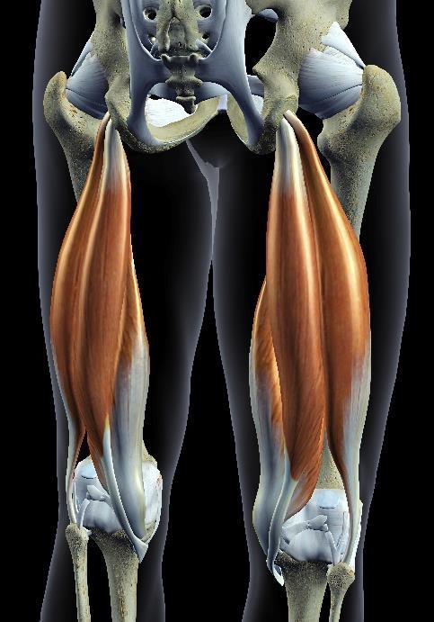 Hamstring Anatomi hamstring Hamstrings er en samlet betegnelse for musklene på baksiden av låret og består av tre muskler: m.