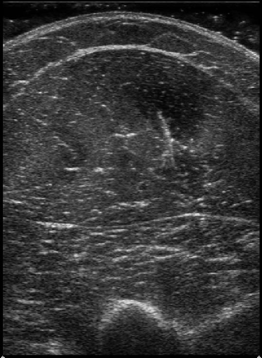 Figur 3.4.2. Ultralydbilder av m. biceps brachii + m. brachialis fra en tilfeldig forsøksperson. Bildene er tatt på samme tidspunkt med to forskjellige ultralydmaskiner.