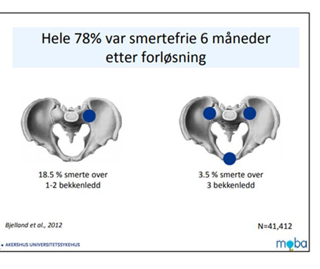 Hva vet vi om prognosen for dem med bekkenleddsmerter.