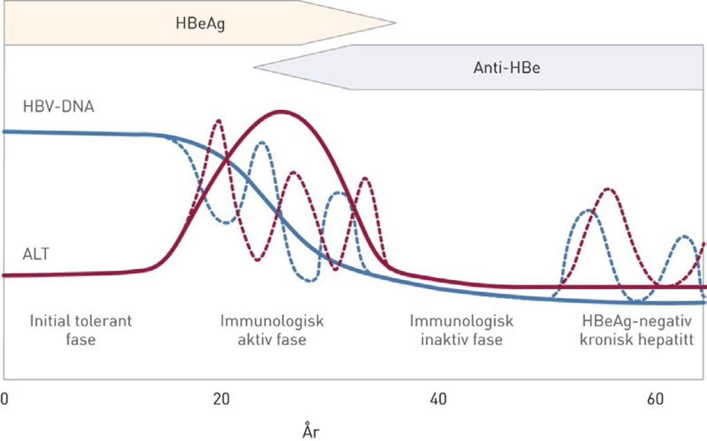 Figur 2. Skjematisk framstilling av de fire fasene av kronisk hepatitt B. Tidsskr Nor Legeforen 2013; 133: 1717-21. 7. Hvordan skal pasienter med HBV core-alene følges opp?