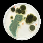 Kupéfilteret ser kanskje ikke så verst ut etter en omgang med vann og børste, men de ørsmå partiklene av pollen, sopp- eller