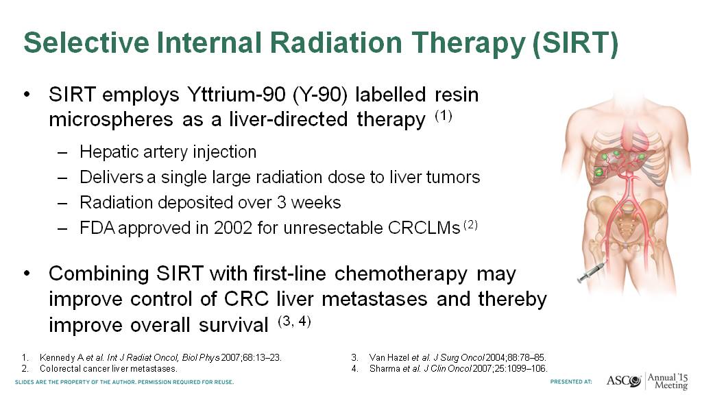 Selective Internal Radiation Therapy (SIRT)