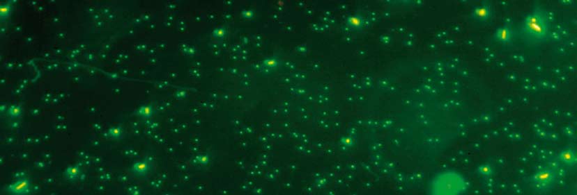 Prøve av sjøvatn. Etter DNA-farging blir prøven filtrert og sett på i epifluorescensmikroskop. Dei store prikkane er bakteriar, dei små er virus.