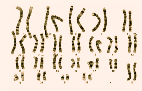 Fig. 6 Normal kvinnelig karyotype. Som tidligere nevnt, kaller vi en persons totale kromosommønster for hennes eller hans karyotype.