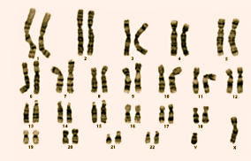 Cytogenetikerne har derfor utviklet en standardisert kode som kan brukes til nøyaktig å beskrive ethvert kromosomavvik.