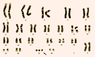 Slike feil innbefatter vanligvis mange gener og deles i to hovedtyper, tallmessige avvik og strukturelle avvik.
