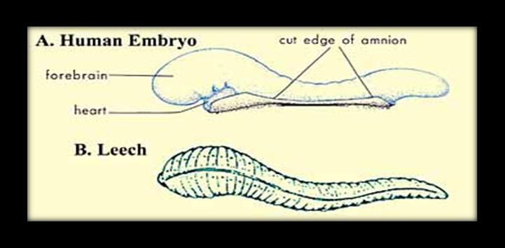 61 Hva er meningen med livet? Figur 1: Tegningen illustrerer likhetene i utseendet mellom en igle og det menneskelige embryo i alaqah-stadiet.